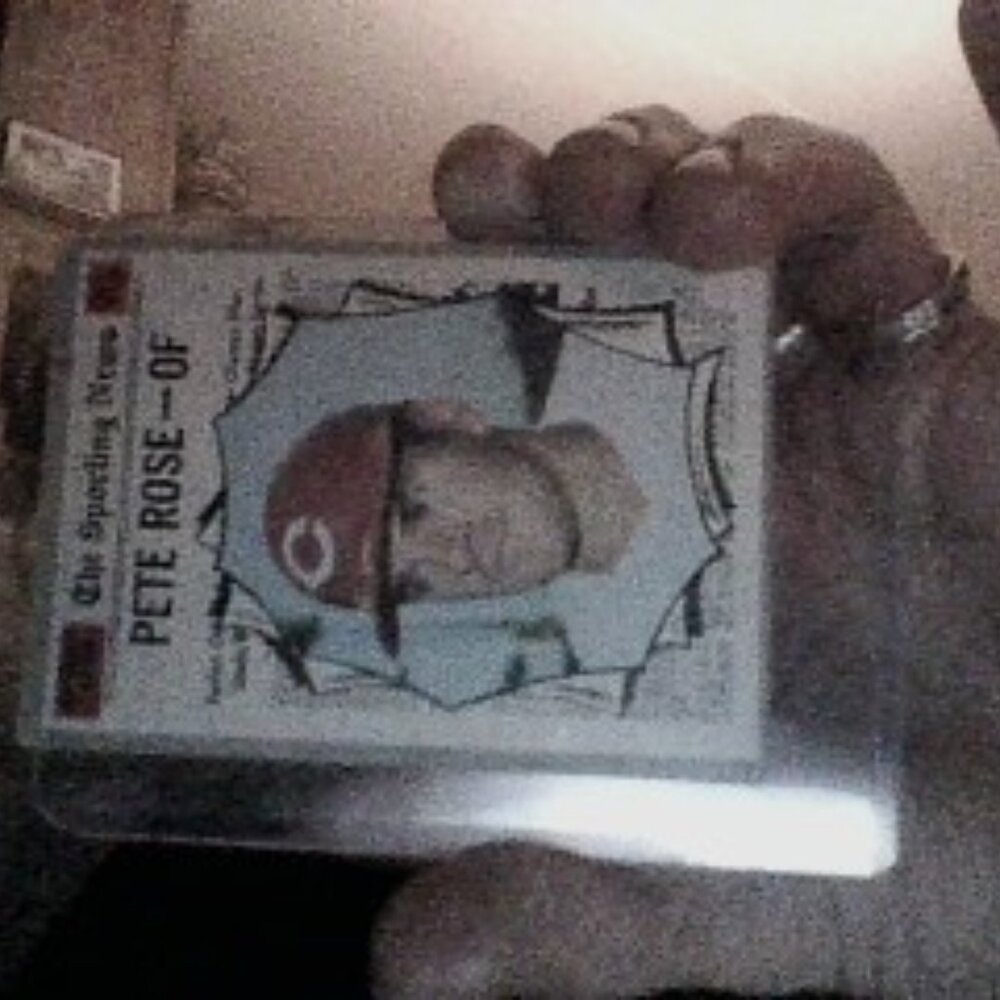 pete rose